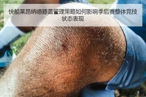快船莱昂纳德膝盖管理策略如何影响季后赛整体竞技状态表现